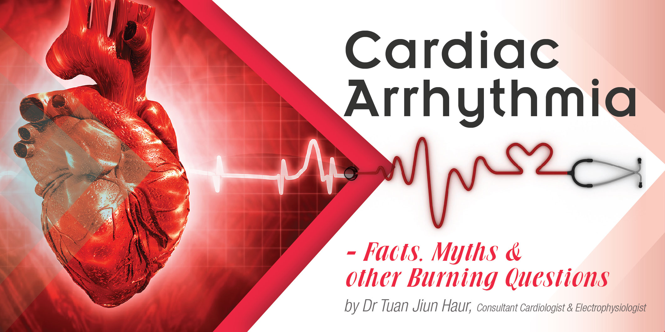 Cardiac-Arrhythmia-01.jpg